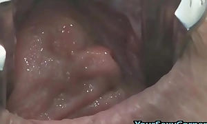 Ground-breaking anal and pussy prolapse after bizarre dp